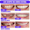 DentalClean® Carillas de Resina para una Sonrisa Natural 2X1